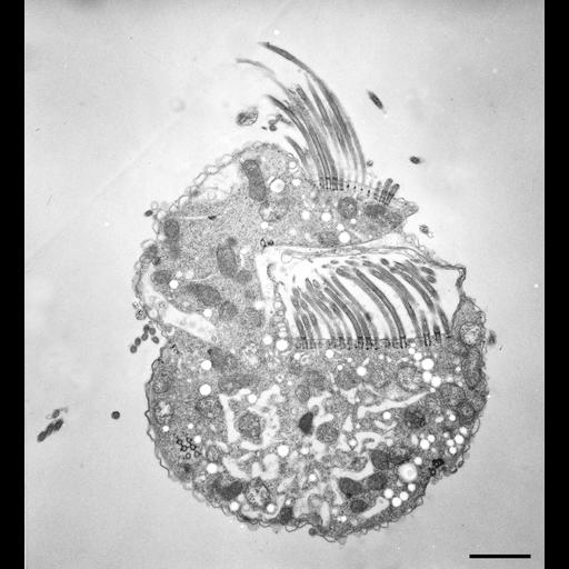  NCBI Organism:Halteria grandinella; Cell Types:cell by organism, eukaryotic cell, , ; Cell Components:oral apparatus, plasma membrane, cytoplasm; Biological process:oral apparatus organization, , cytoplasm organization;