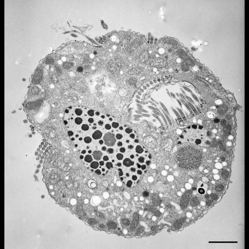  NCBI Organism:Halteria grandinella; Cell Types:cell by organism, eukaryotic cell, , ; Cell Components:macronucleus, micronucleus, oral apparatus, contractile vacuole; Biological process:oral apparatus organization, macronucleus organization, micronucleus organization;