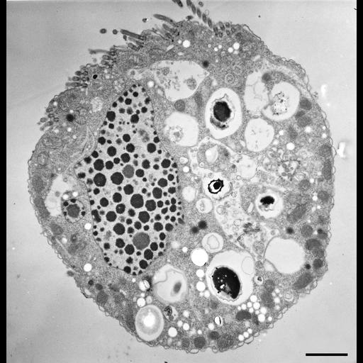  NCBI Organism:Halteria grandinella; Cell Types:cell by organism, eukaryotic cell, , ; Cell Components:oral apparatus, macronucleus, food vacuole; Biological process:oral apparatus organization, macronucleus organization;