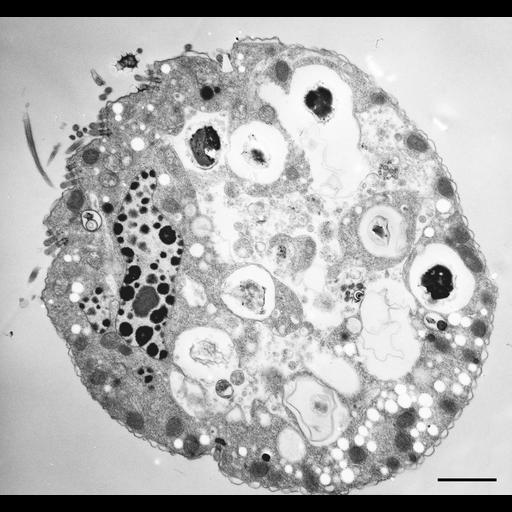  NCBI Organism:Halteria grandinella; Cell Types:cell by organism, eukaryotic cell, , ; Cell Components:macronucleus, oral apparatus, food vacuole; Biological process:macronucleus organization, oral apparatus organization, response to food;