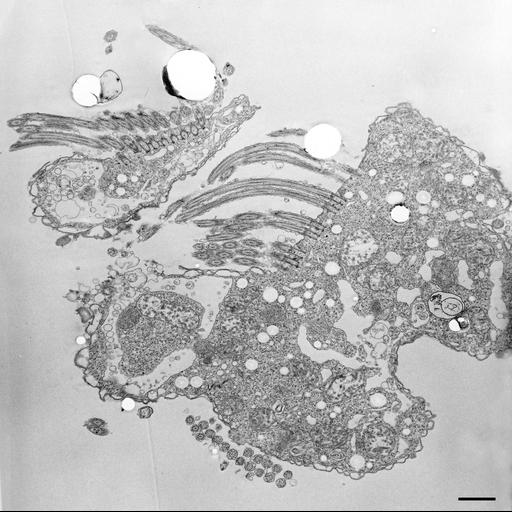  NCBI Organism:Halteria grandinella; Cell Types:cell by organism, eukaryotic cell, , ; Cell Components:contractile vacuole, contractile vacuole pore, cytoplasm; Biological process:contractile vacuole organization, contractile vacuole discharge, cytoplasm organization;