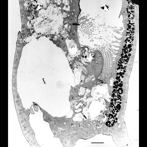  NCBI Organism:Euplotes sp.; Cell Types:cell by organism, eukaryotic cell, , ; Cell Components:cilium, cytoplasm, macronucleus, food vacuole, contractile vacuole, ; Biological process:ciliary or flagellar motility, macronucleus organization, cytoplasm organization;