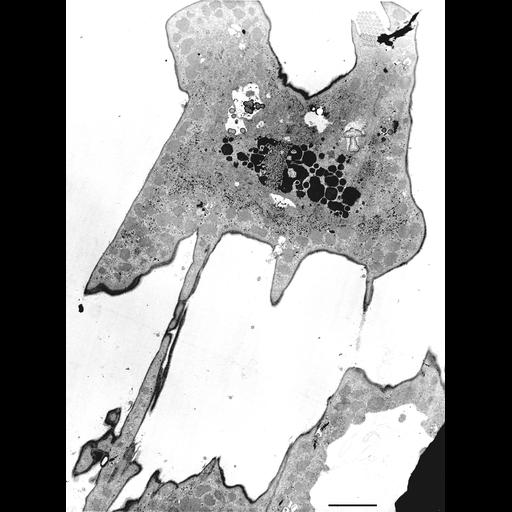  NCBI Organism:Euplotes sp.; Cell Types:cell by organism, eukaryotic cell, , ; Cell Components:cilium, cytoplasm, macronucleus, contractile vacuole; Biological process:ciliary or flagellar motility, macronucleus organization, DNA replication checkpoint, cytoplasm organization;