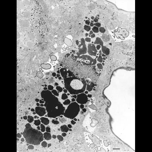  NCBI Organism:Euplotes sp.; Cell Types:cell by organism, eukaryotic cell, , ; Cell Components:cytoplasm, macronucleus, food vacuole, contractile vacuole; Biological process:macronucleus organization, cytoplasm organization, ;