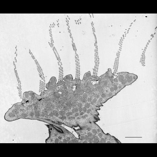  NCBI Organism:Euplotes sp.; Cell Types:cell by organism, eukaryotic cell, , ; Cell Components:oral apparatus, mitochondrion; Biological process:oral/aboral axis specification, oral apparatus organization, cytoplasm organization;