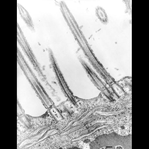  NCBI Organism:Euplotes sp.; Cell Types:cell by organism, eukaryotic cell, , ; Cell Components:cilium, cilium axoneme, microtubule basal body; Biological process:ciliary or flagellar motility, microtubule basal body organization, cytoplasm organization;