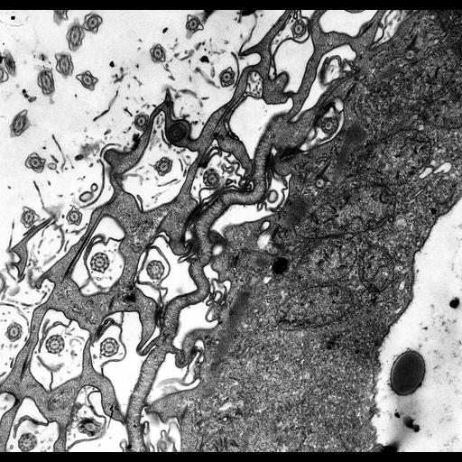  NCBI Organism:Paramecium multimicronucleatum; Cell Types:cell by organism, eukaryotic cell, , ; Cell Components:cytoproct, cell cortex, cytoplasm; Biological process:cortical cytoskeleton organization