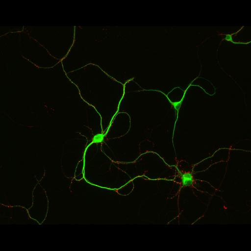  NCBI Organism:Rattus; Cell Types:multipolar neuron Cell Components:synapse, microtubule cytoskeleton, dendrite; Biological process:dendrite development, establishment of cell polarity, synaptic transmission, central nervous system neuron development;