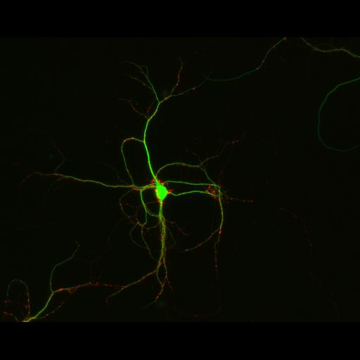  NCBI Organism:Rattus; Cell Types:multipolar neuron Cell Components:synapse, microtubule cytoskeleton, dendrite; Biological process:dendrite development, establishment of cell polarity, synaptic transmission, central nervous system neuron development;