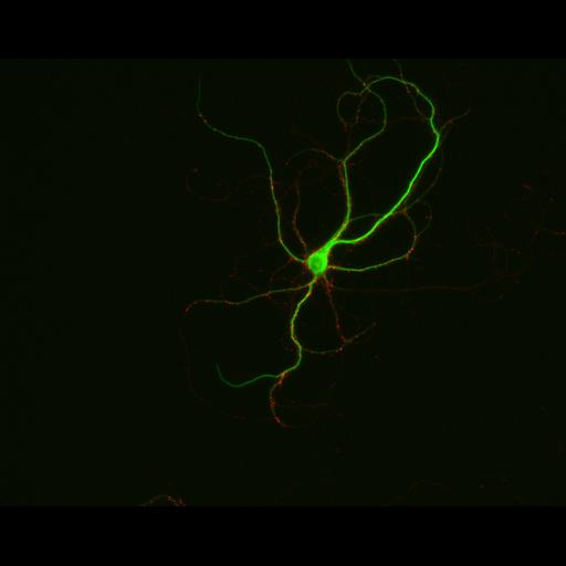  NCBI Organism:Rattus; Cell Types:multipolar neuron Cell Components:synapse, microtubule cytoskeleton, dendrite; Biological process:dendrite development, establishment of cell polarity, synaptic transmission, central nervous system neuron development;