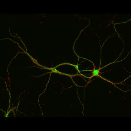  NCBI Organism:Rattus; Cell Types:multipolar neuron Cell Components:synapse, microtubule cytoskeleton, dendrite; Biological process:dendrite development, establishment of cell polarity, synaptic transmission, central nervous system neuron development;