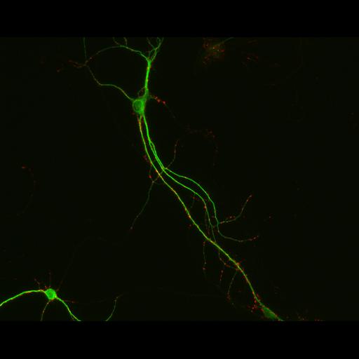  NCBI Organism:Rattus; Cell Types:multipolar neuron Cell Components:synapse, microtubule cytoskeleton, dendrite; Biological process:dendrite development, establishment of cell polarity, synaptic transmission, central nervous system neuron development;