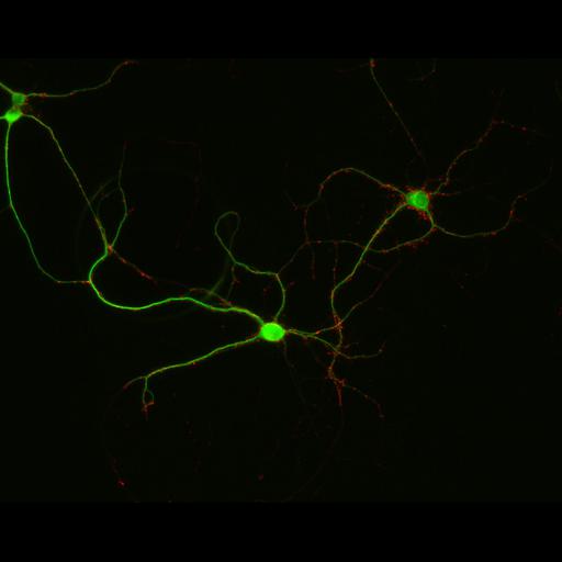  NCBI Organism:Rattus; Cell Types:multipolar neuron Cell Components:synapse, microtubule cytoskeleton, dendrite; Biological process:dendrite development, establishment of cell polarity, synaptic transmission, central nervous system neuron development;