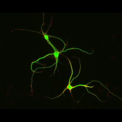  NCBI Organism:Rattus; Cell Types:multipolar neuron Cell Components:synapse, microtubule cytoskeleton, dendrite; Biological process:dendrite development, establishment of cell polarity, synaptic transmission, central nervous system neuron development;