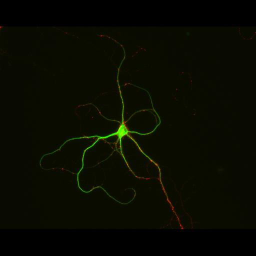  NCBI Organism:Rattus; Cell Types:multipolar neuron Cell Components:synapse, microtubule cytoskeleton, dendrite; Biological process:dendrite development, establishment of cell polarity, synaptic transmission, central nervous system neuron development;