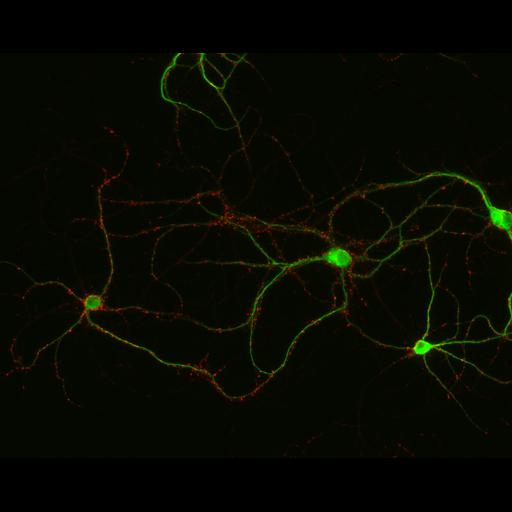  NCBI Organism:Rattus; Cell Types:multipolar neuron Cell Components:synapse, microtubule cytoskeleton, dendrite; Biological process:dendrite development, establishment of cell polarity, synaptic transmission, central nervous system neuron development;