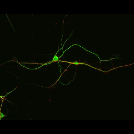  NCBI Organism:Rattus; Cell Types:multipolar neuron Cell Components:synapse, microtubule cytoskeleton, dendrite; Biological process:dendrite development, establishment of cell polarity, synaptic transmission, central nervous system neuron development;