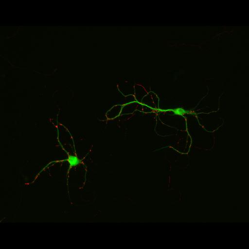  NCBI Organism:Rattus; Cell Types:multipolar neuron Cell Components:synapse, microtubule cytoskeleton, dendrite; Biological process:dendrite development, establishment of cell polarity, synaptic transmission, central nervous system neuron development;