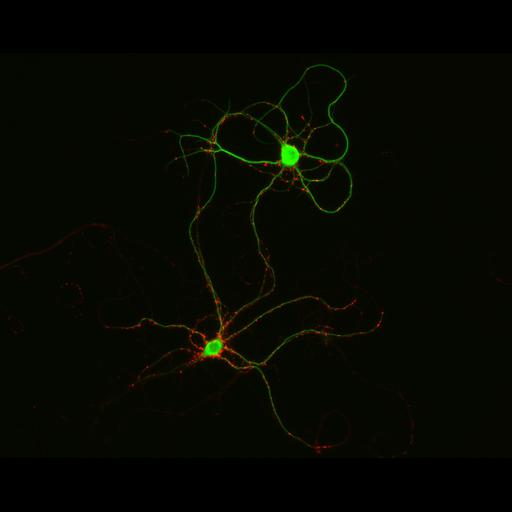  NCBI Organism:Rattus; Cell Types:multipolar neuron Cell Components:synapse, microtubule cytoskeleton, dendrite; Biological process:dendrite development, establishment of cell polarity, synaptic transmission, central nervous system neuron development;