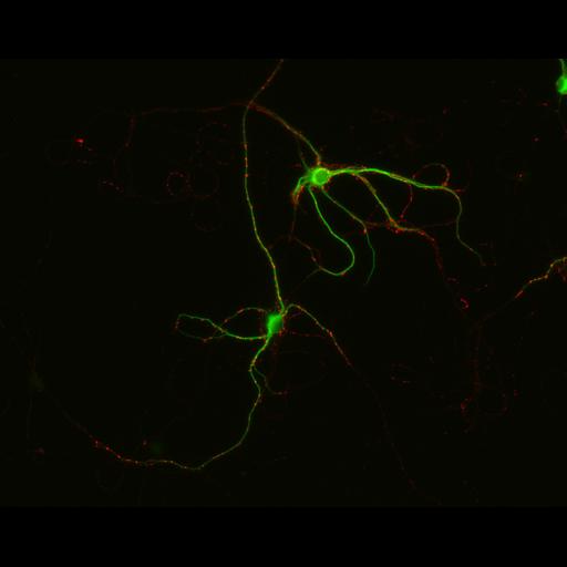  NCBI Organism:Rattus; Cell Types:multipolar neuron Cell Components:synapse, microtubule cytoskeleton, dendrite; Biological process:dendrite development, establishment of cell polarity, synaptic transmission, central nervous system neuron development;