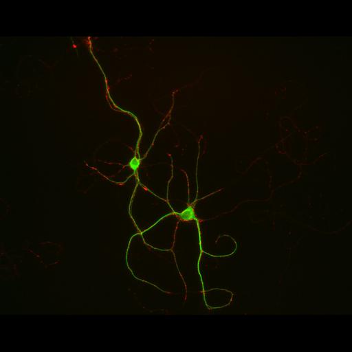  NCBI Organism:Rattus; Cell Types:multipolar neuron Cell Components:synapse, microtubule cytoskeleton, dendrite; Biological process:dendrite development, establishment of cell polarity, synaptic transmission, central nervous system neuron development;