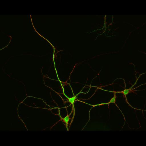  NCBI Organism:Rattus; Cell Types:multipolar neuron Cell Components:synapse, microtubule cytoskeleton, dendrite; Biological process:dendrite development, establishment of cell polarity, synaptic transmission, central nervous system neuron development;