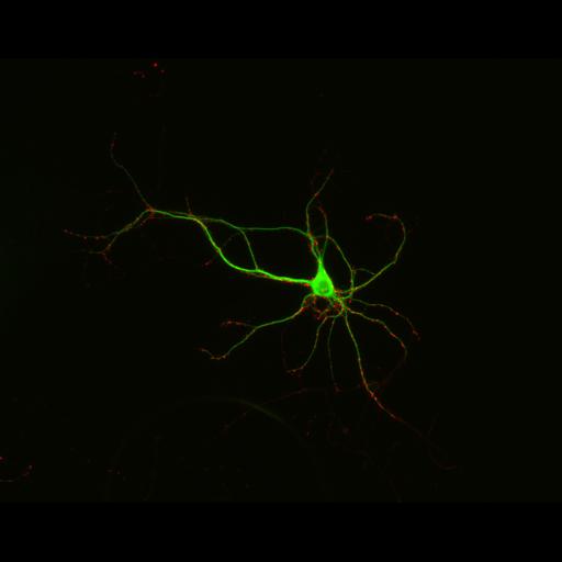  NCBI Organism:Rattus; Cell Types:multipolar neuron Cell Components:synapse, microtubule cytoskeleton, dendrite; Biological process:dendrite development, establishment of cell polarity, synaptic transmission, central nervous system neuron development;