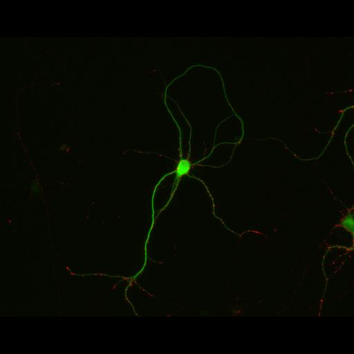  NCBI Organism:Rattus; Cell Types:multipolar neuron Cell Components:synapse, microtubule cytoskeleton, dendrite; Biological process:dendrite development, establishment of cell polarity, synaptic transmission, central nervous system neuron development;