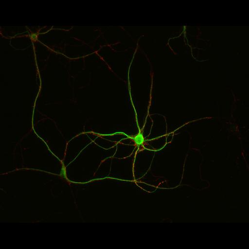  NCBI Organism:Rattus; Cell Types:multipolar neuron Cell Components:synapse, microtubule cytoskeleton, dendrite; Biological process:dendrite development, establishment of cell polarity, synaptic transmission, central nervous system neuron development;