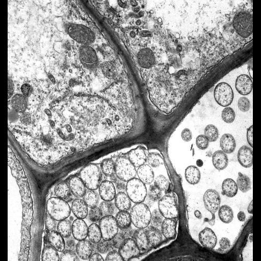  NCBI Organism:Spiroplasma kunkelii, Zea mays, ; Cell Types:plant cell, , prokaryotic cell; Cell Components:mitochondrion, plant-type cell wall; Biological process:pathogenesis