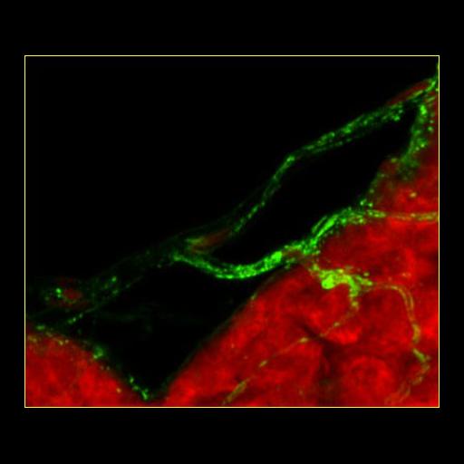 CIL:12581, Spiroplasma kunkelii, Dalbulus maidis, prokaryotic cell. CIL ...