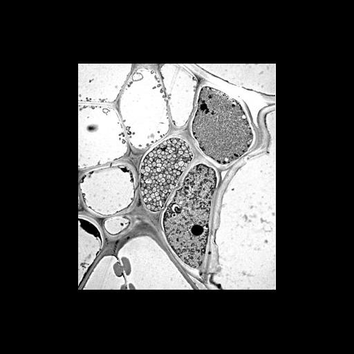  NCBI Organism:Spiroplasma kunkelii, Zea mays, ; Cell Types:plant cell, , , prokaryotic cell; Cell Components:nucleus, cell wall; Biological process:pathogenesis