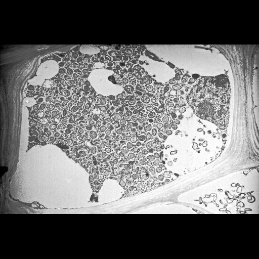  NCBI Organism:Spiroplasma kunkelii, Zea mays, ; Cell Types:plant cell, , prokaryotic cell; Cell Components:plant-type cell wall, plant-type vacuole; Biological process:pathogenesis