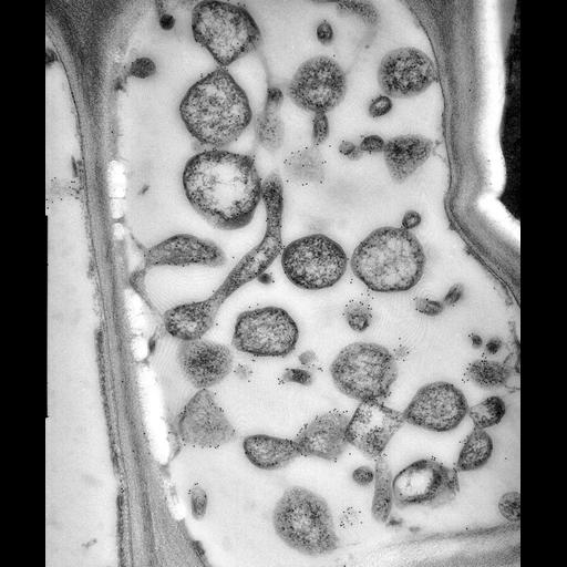  NCBI Organism:Spiroplasma kunkelii, Zea mays, ; Cell Types:plant cell, , prokaryotic cell; Cell Components:plant-type cell wall Biological process:pathogenesis