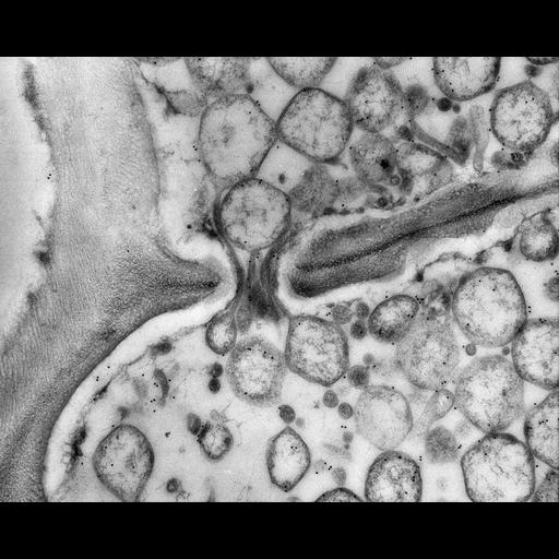  NCBI Organism:Spiroplasma kunkelii, Zea mays, ; Cell Types:plant cell, , prokaryotic cell; Cell Components:pore complex, plant-type cell wall; Biological process:pathogenesis