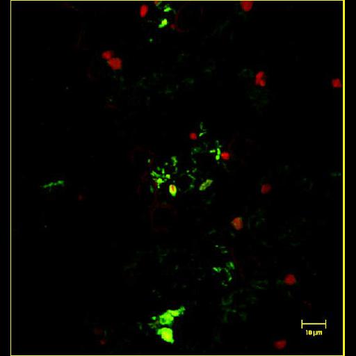  NCBI Organism:Spiroplasma kunkelii, Zea mays, ; Cell Types:plant cell, , prokaryotic cell; Cell Components:nucleus, bacteroid-containing symbiosome; Biological process:pathogenesis