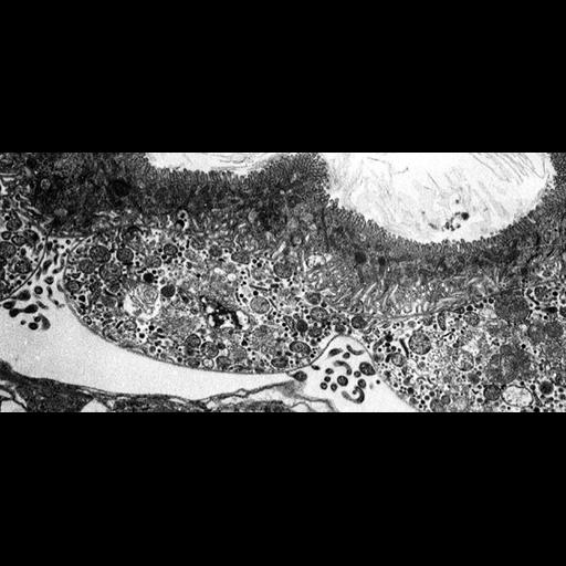  NCBI Organism:Spiroplasma kunkelii, Dalbulus gelbus, ; Cell Types:epithelial cell, prokaryotic cell, ; Cell Components:basal lamina Biological process:pathogenesis