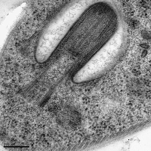  NCBI Organism:Trypanosoma brucei; Cell Types:cell by organism, eukaryotic cell, , ; Cell Components:microtubule basal body, axoneme, axoneme part, cortical microtubule, transverse to long axis; Biological process:ciliary or flagellar motility, flagellar axoneme assembly, ciliary or flagellar motility, cortical microtubule organization, ;