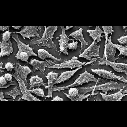  NCBI Organism:Homo sapiens; Cell Types:epithelial cell Cell Components:cell, cell surface; Biological process:cytokinesis after mitosis