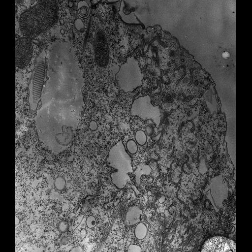  NCBI Organism:Paramecium multimicronucleatum; Cell Types:cell by organism, eukaryotic cell, , ; Cell Components:cytoproct, cell cortex, microtubule; Biological process:microtubule cytoskeleton organization