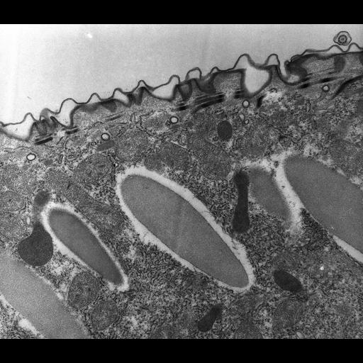  NCBI Organism:Paramecium multimicronucleatum; Cell Types:eukaryotic cell, , ; Cell Components:cell cortex, plasma membrane, peroxisome, coated pit, trichocyst; Biological process:, peroxisome localization, plasma membrane organization, clathrin coat assembly;