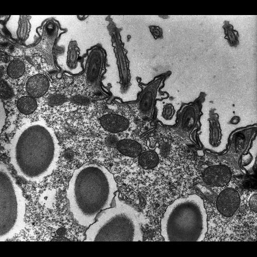  NCBI Organism:Paramecium multimicronucleatum; Cell Types:cell by organism, eukaryotic cell, , ; Cell Components:cell cortex, axoneme, trichocyst, plasma membrane, coated pit; Biological process:cortical cytoskeleton organization, , , clathrin coat assembly;