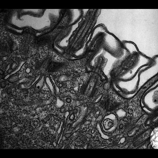  NCBI Organism:Paramecium multimicronucleatum; Cell Types:cell by organism, eukaryotic cell, , ; Cell Components:cell cortex, coated pit, clathrin vesicle coat, clathrin coat of endocytic vesicle, endosome, cell cortex; Biological process:cortical cytoskeleton organization, endosome organization, clathrin coat assembly;