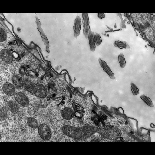  NCBI Organism:Paramecium multimicronucleatum; Cell Types:cell by organism, eukaryotic cell, , ; Cell Components:cell cortex, clathrin coat of endocytic vesicle; Biological process:cortical cytoskeleton organization, clathrin coating of Golgi vesicle, plasma membrane to endosome targeting;