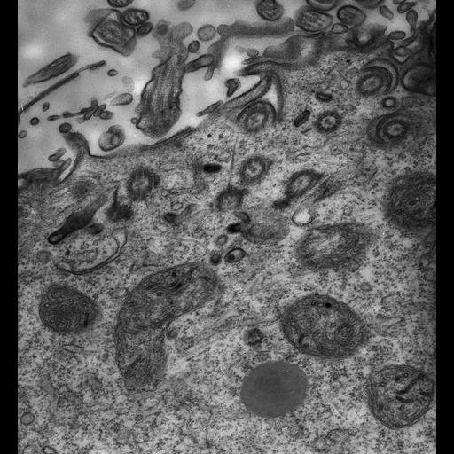  NCBI Organism:Paramecium multimicronucleatum; Cell Types:cell by organism, eukaryotic cell, , ; Cell Components:cell cortex, endosome; Biological process:cortical cytoskeleton organization, endosome organization, clathrin coating of Golgi vesicle, plasma membrane to endosome targeting;