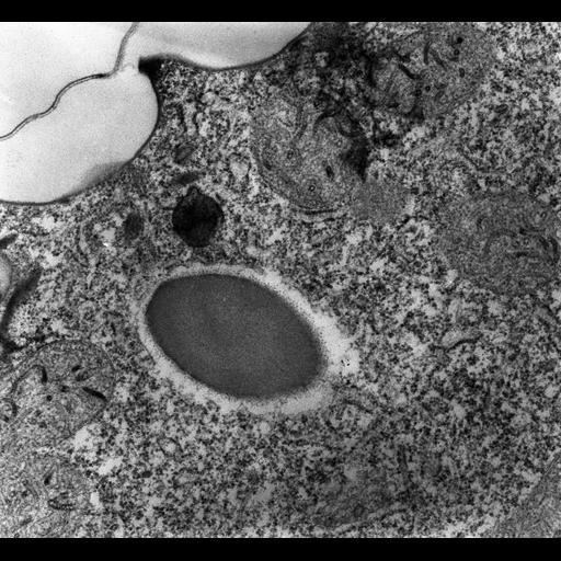  NCBI Organism:Paramecium multimicronucleatum; Cell Types:cell by organism, eukaryotic cell, , ; Cell Components:cell cortex, endosome; Biological process:endosome organization, endosome to lysosome transport;