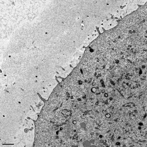  NCBI Organism:Mus musculus; Cell Types:oocyte Cell Components:cell cortex, microvillus, ; Biological process:fertilization