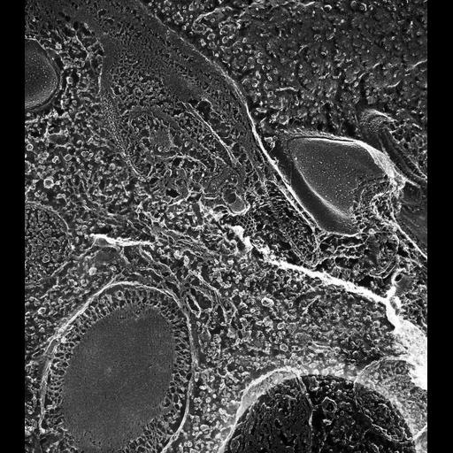  NCBI Organism:Paramecium multimicronucleatum; Cell Types:cell by organism, eukaryotic cell, , ; Cell Components:clathrin coat of endocytic vesicle, early endosome, integral to endosome membrane; Biological process:early endosome to Golgi transport, clathrin coating of Golgi vesicle, plasma membrane to endosome targeting;