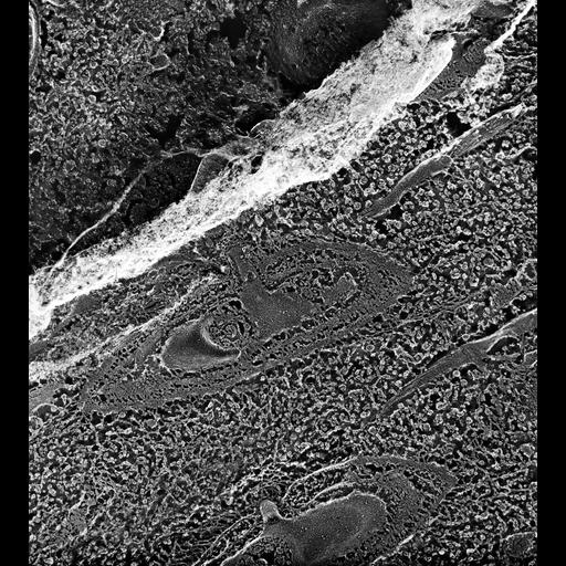  NCBI Organism:Paramecium multimicronucleatum; Cell Types:cell by organism, eukaryotic cell, , ; Cell Components:coated pit, clathrin coat, clathrin coat of endocytic vesicle, early endosome, early endosome membrane, early endosome lumen; Biological process:endosome organization, clathrin coat assembly, endosome organization;