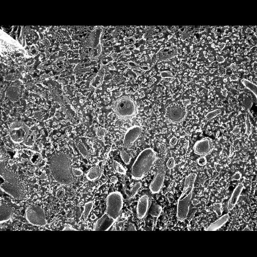  NCBI Organism:Paramecium multimicronucleatum; Cell Types:cell by organism, eukaryotic cell, , ; Cell Components:cytoplasm, early endosome, clathrin coat of endocytic vesicle; Biological process:cytoplasm organization, endosome organization, clathrin coat assembly;